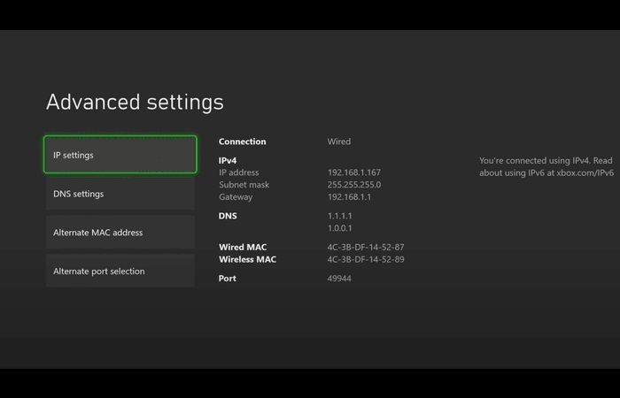Xbox DNS Settings